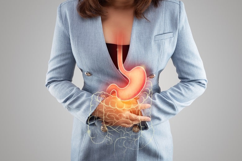 Heartburn, Acid Reflux, Indigestion: Three Imposters, and How to Deal with Them