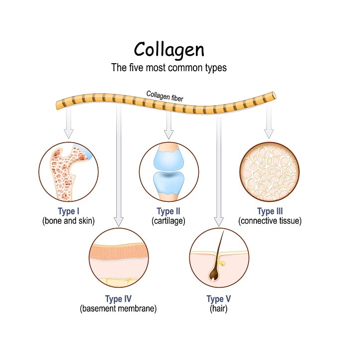 The most widely understood types of collagen are I, II, III, IV, and V